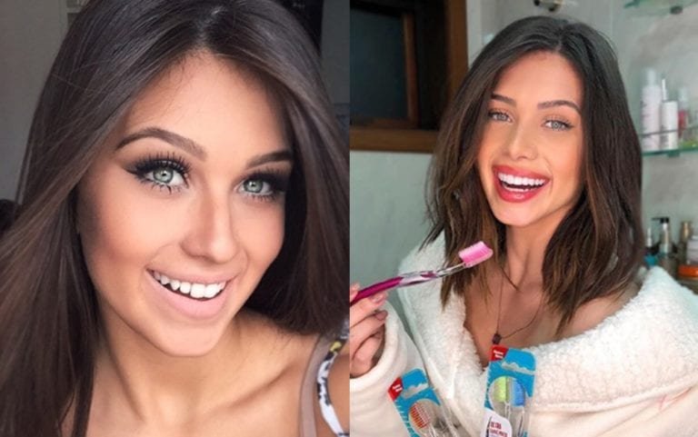 Flávia Pavanelli antes e depois com lentes