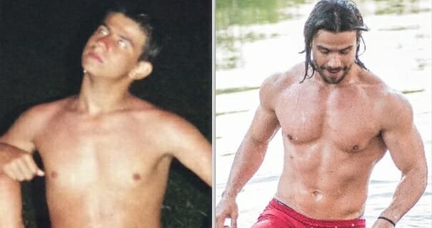 Veja o antes e o depois de Mariano, após cirurgias